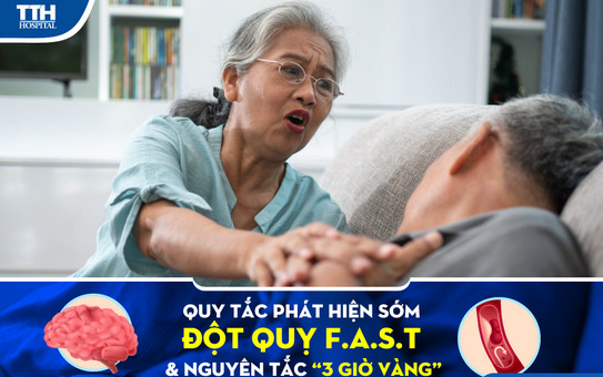 Quy tắc phát hiện sớm đột quỵ F.A.S.T và nguyên tắc "3 giờ vàng"