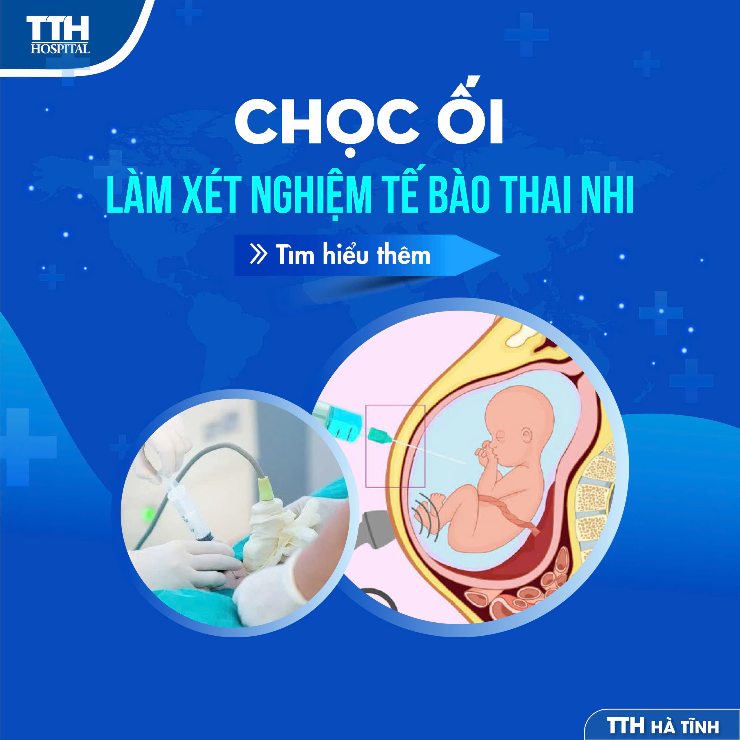 CHỌC ỐI LÀM XÉT NGHIỆM TẾ BÀO THAI NHI