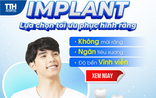 Trồng răng Implant an toàn - hiệu quả-bền vững