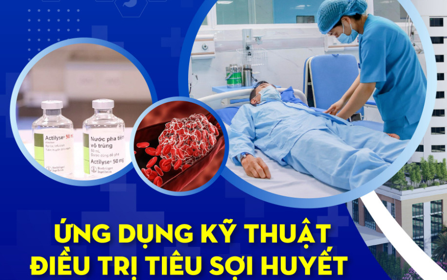 ỨNG DỤNG KỸ THUẬT ĐIỀU TRỊ TIÊU SỢI HUYẾT CHO BỆNH NHÂN TAI BIẾN MẠCH MÁU NÃO