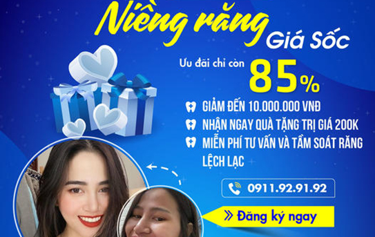 Tuần lễ vàng niềng răng giá gốc