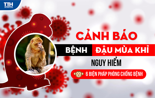 CHỦ ĐỘNG, TĂNG CƯỜNG BIỆN PHÁP PHÒNG CHỐNG BỆNH ĐẬU MÙA KHỈ