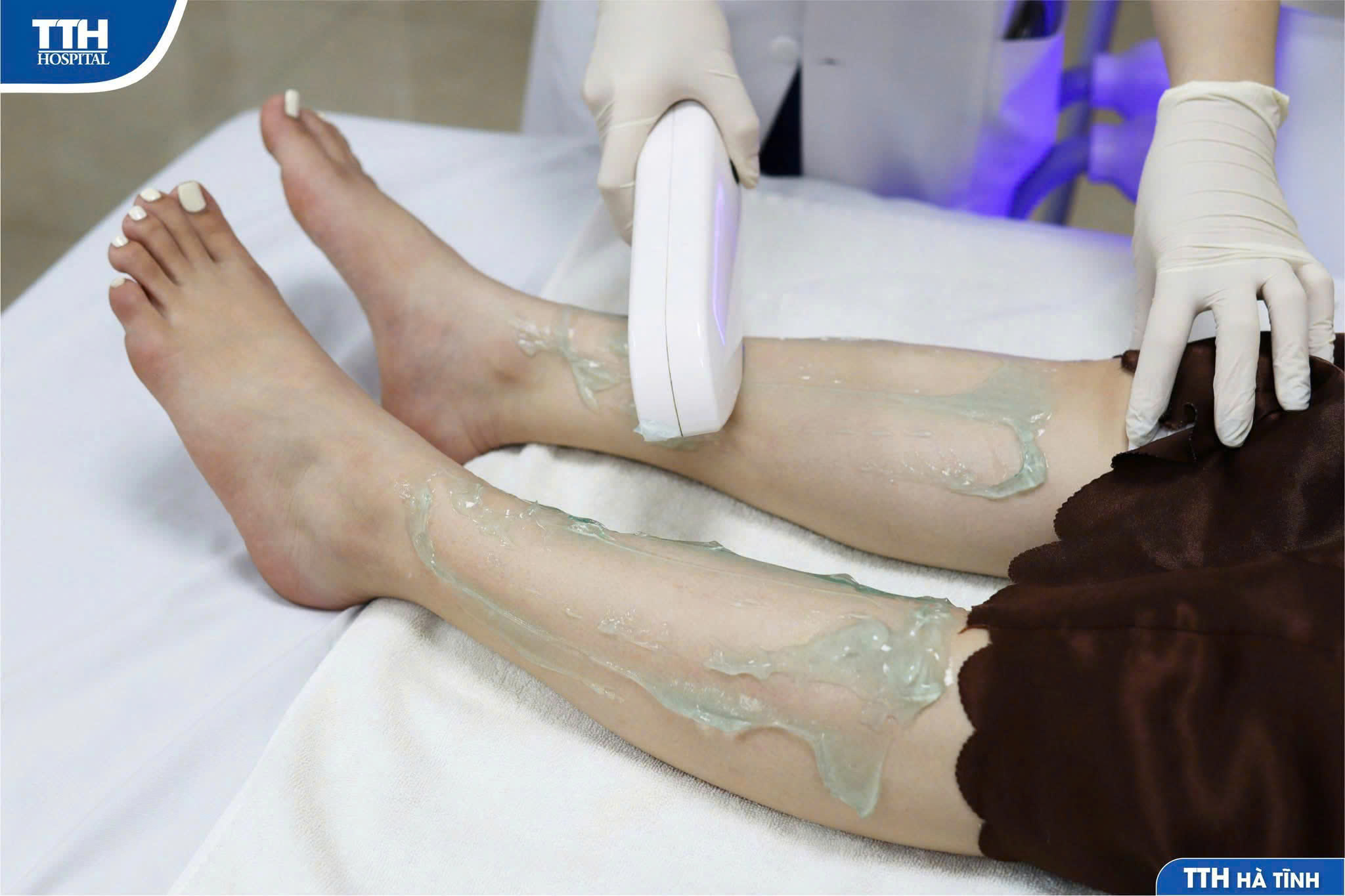 GIẢI PHÁP TRIỆT LÔNG HIỆU QUẢ VỚI CÔNG NGHỆ ÁNH SÁNG IPL