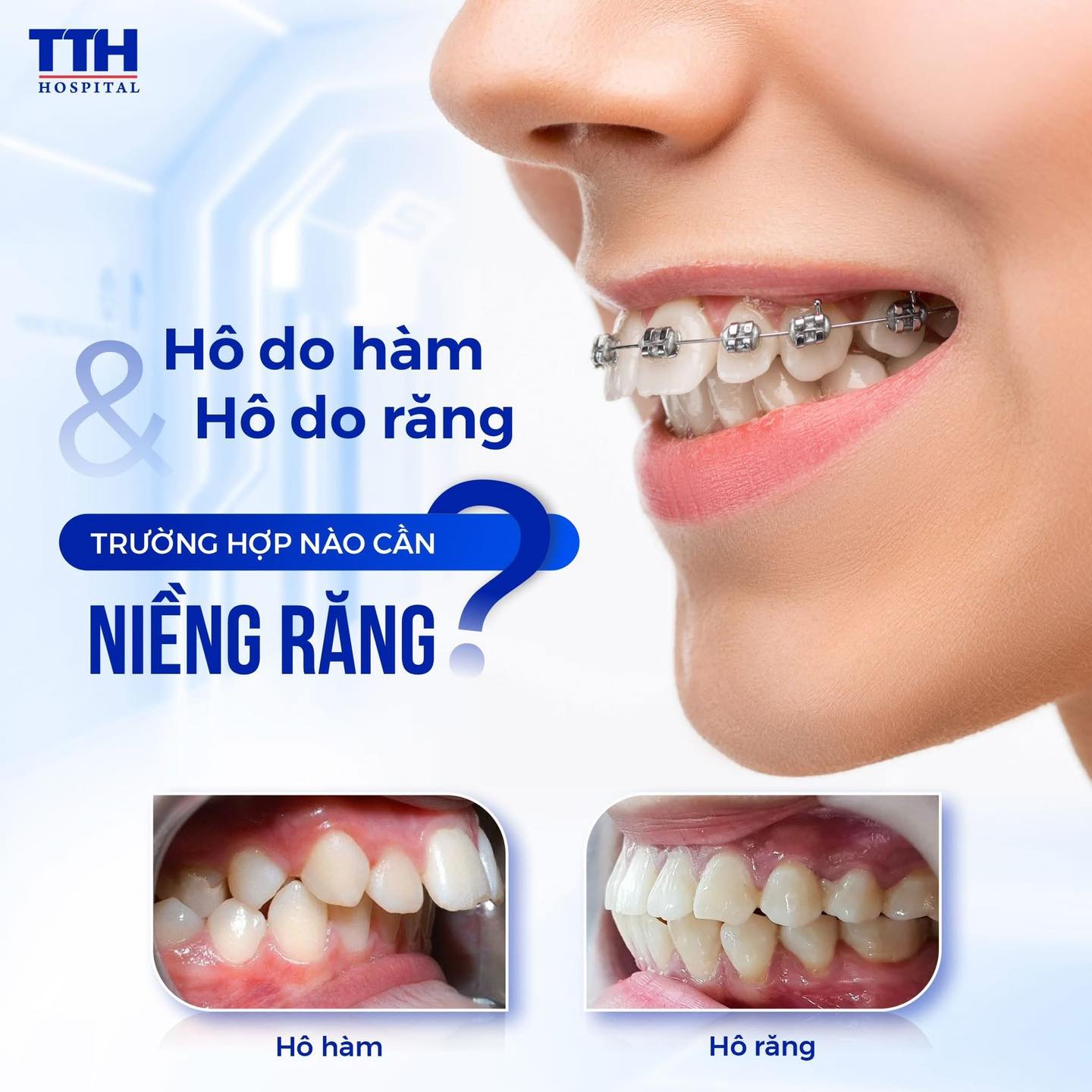 HÔ - NIỀNG LÀ HẾT? KHÔNG HẲN ĐÂU