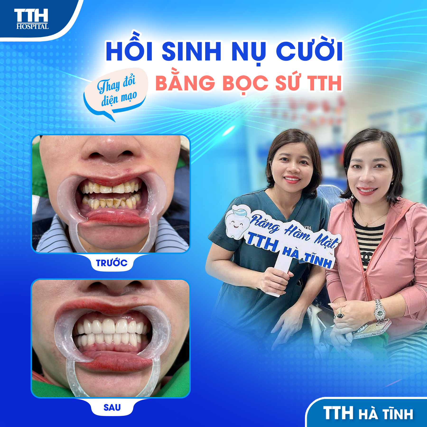 ĐỔI MÀU NỤ CƯỜI, ĐỔI CẢ THẦN THÁI - ÁP DỤNG CÔNG THỨC 2-1-5 LÀ RA