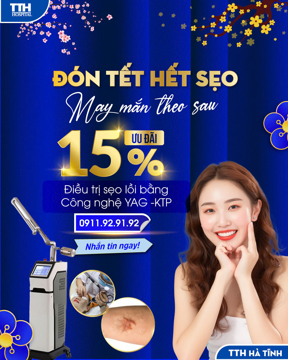 ĐÓN TẾT HẾT SẸO - MAY MẮN THEO SAU