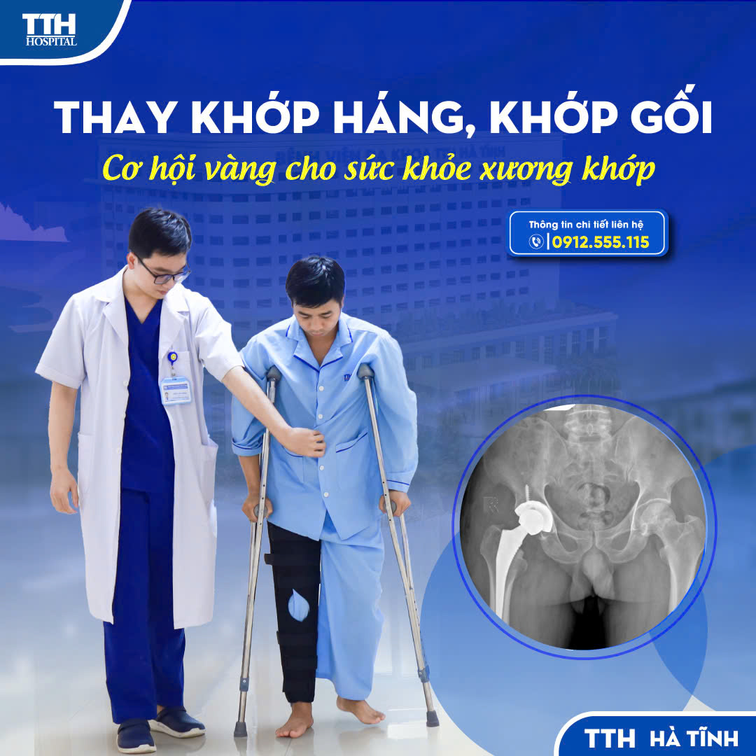 CƠ HỘI VÀNG CHO SỨC KHỎE XƯƠNG KHỚP – THAY KHỚP HÁNG, KHỚP GỐI